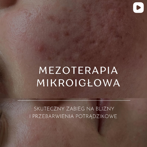 Besthetic Clinic, Instagram-Post, Gabinet Medycyny Estetycznej, Kosmetologia, Medycyna Estetyczna